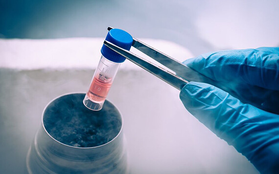 Fertility-Preservation-in-Delhi-Dr-Rhythm-Gupta-Excel-IVF-01 (1)