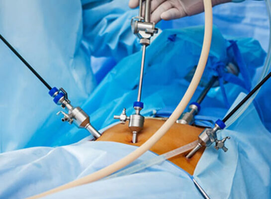 laparoscopy-for-infertility-Dr-Rhythm-Gupta