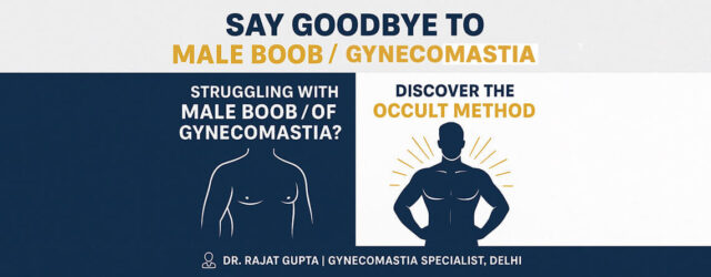 Say-Goodbye-to-Male-Boob-Gynecomastia-surgery-with-the-OCCULT-Method-Dr-Rajat-Gupta-RG-Aesthetics-011